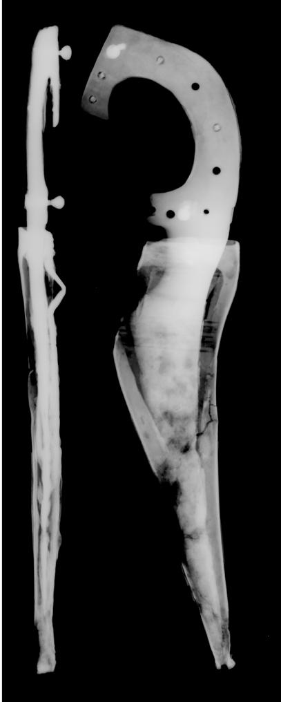 Radelet). / Radiografia del fodero A.20992b di un coltello da Lovere (Th. Radelet). Fig.