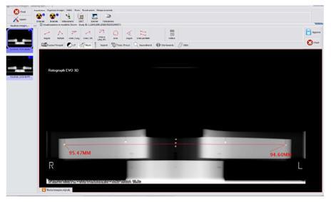 Slika 32 Prikaz snimke fantom alata za kalibraciju i označene mjerne točke 1 Slika 33 Prikaz snimke fantom alata za kalibraciju i označene mjerne točke 2 (izvor