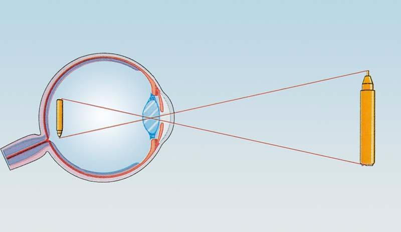 Slika 4.1. Formiranje slike u oku 4.2. Anatomija oka Ljudsko oko sastoji se od očne jabučice uložene u očnu šupljinu. Zaštitu oka čine gornja i donja vjeđa, obrve, trepavice i spojnice.