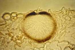 miceliju ili mogu nastati u nespolnim plodištima PIKNIDIMA