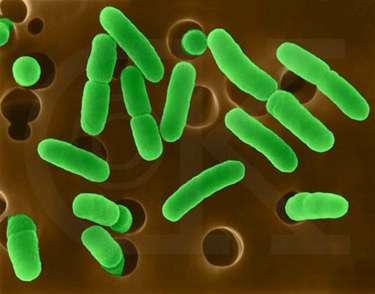 FITOPATOGENE BAKTERIJE - bakterioze - više od 300 vrsta i varijeteta fitopatogenih bakterija - parazitiraju na