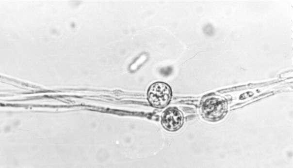 nastaju u miceliju ili u