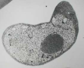GRAĐA TIJELA GLJIVA Pseudogljive i neke prave gljive (Chytridiomycetes, Synhitrium endobioticum) imaju tijelo izgrađeno iz gole protoplazmatične mase Nespolno se razmnožavaju zoosporama Spolno