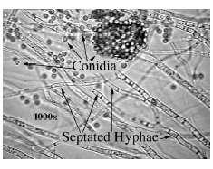jednostaničan (NESEPTIRAN) ili višestaničan (SEPTIRAN) - neseptiran micelij
