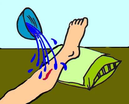 are clean Prepare an antiseptic solution. Clean the wound.
