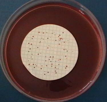 5ºC është kultivuar Escherichia coli (koloni me shkëlqim metalik) (Fig I-11), si dhe është përdorur terreni mfc Agar në disa raste për të vertetuar praninë e Escherichia coli, e cila jep koloni me