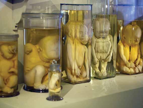 One feature that is still housed are the deformed anatomical specimens in jars prepared