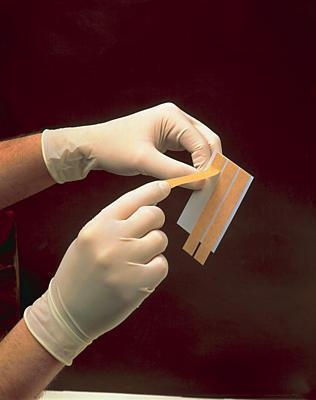Prepare the skin around the wound cutting carefully, wipe away dead tissue if needed. Wipe the skin with an alcohol wipe, not allowing the alcohol touch the inside of the wound.