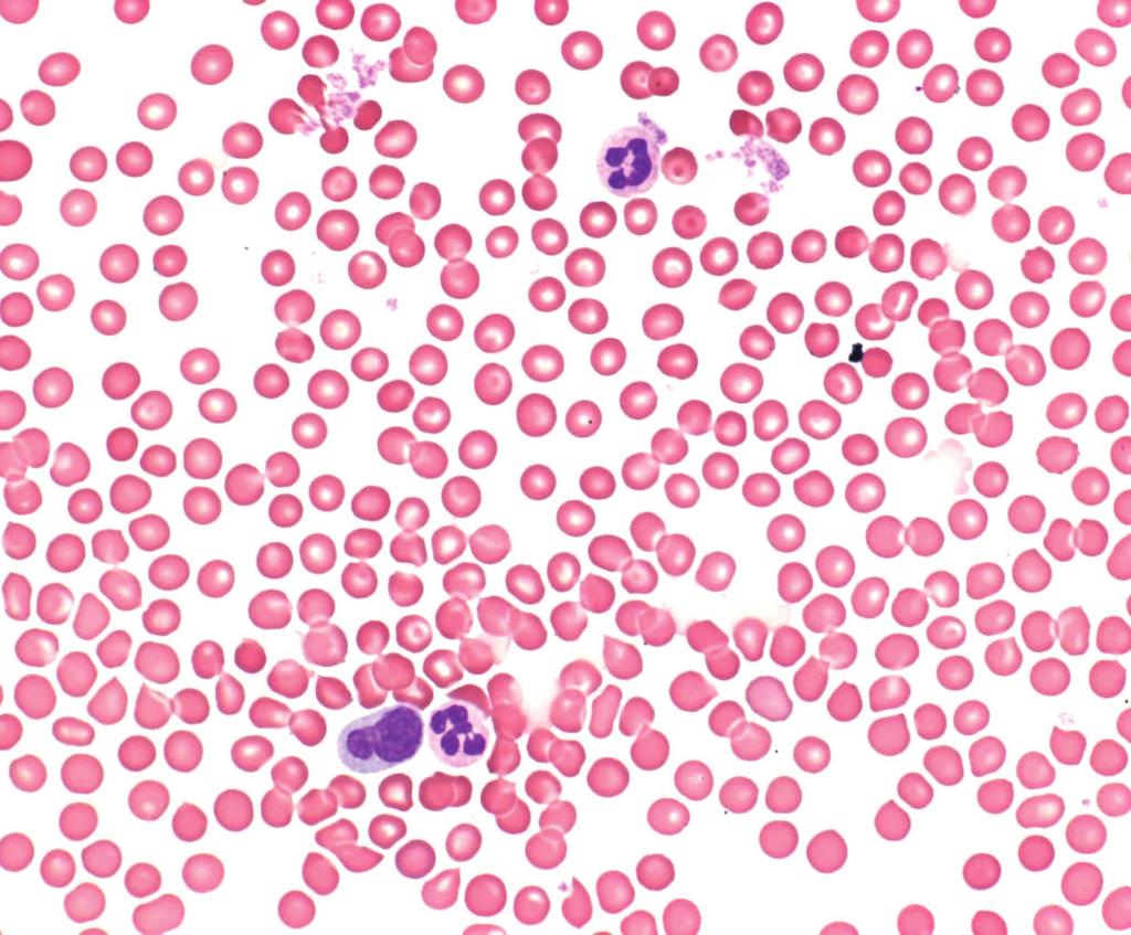 Hematology Reagents to identify diseases of the blood and blood forming organs The HARLECO product line offers ready to use staining solutions for blood and bone marrow samples that yield intense and