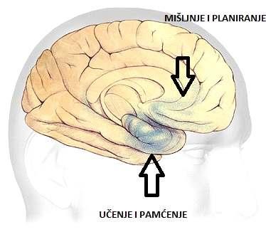 Alzheimerova bolest je bolest kod koje je demencija direktan uzrok oboljenja središnjeg živčanog sustava.