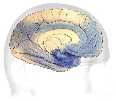 Slika 2.2.5. Mozak u teškoj fazi Alzheimerove bolest Izvor: https://alzheimer.hr/ 2.3.