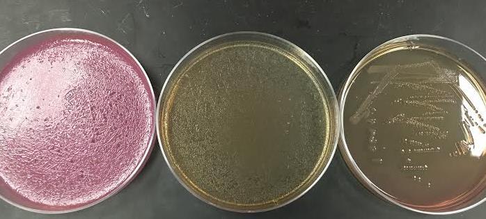 E. coli O157: H7