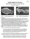 Giardia lamblia and Giardiasis