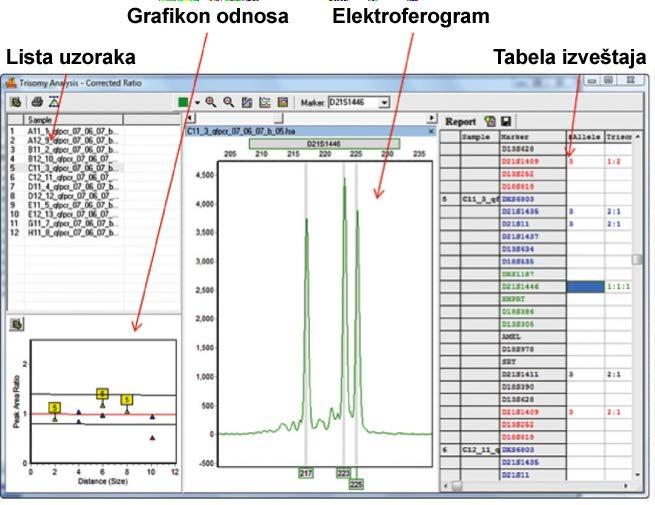 Prozor Trisomy Analysis (Analiza trizomije) Prozor Trisomy Analysis (Analiza trizomije) (Slika 11) omogućava rukovaocu da pregleda podatke QST*R uzorka, prikaže odnos šiljaka za svaki marker i