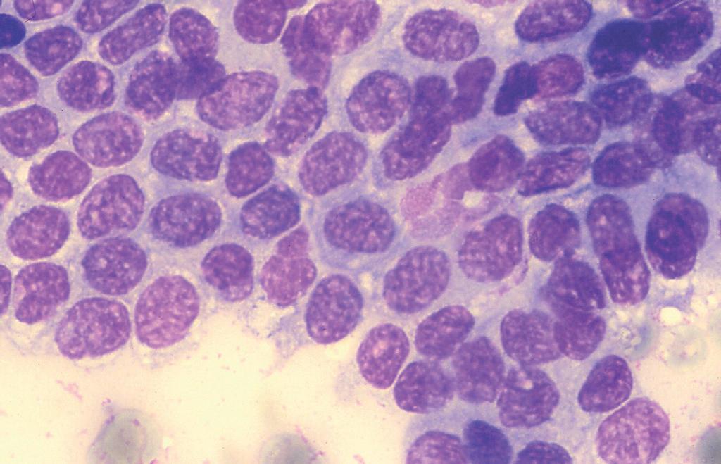 Epiteliálne žľazové tkanivo Tento typ buniek máva tendenciu spájať sa jedna s druhou. Môžu vytvárať aj dvoj- alebo trojrozmerné zhluky, ale nachádzame ich aj v jednej vrstve (obr. 5), v acinoch (obr.