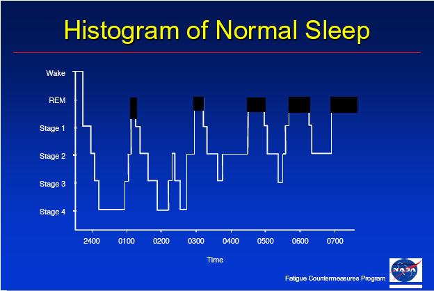 Dr. Nasim Zaidi Committee Report Chapter 3 Scientific Principles and Knowledge 3.9 The graph portrays a typical night of sleep for a normal adult. It exemplifies the sleep architecture.