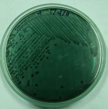 Qui trình PCR khuẩn lạc phát hiện S. agalactiae: Vi khuẩn S. agalactiae được cấy lên môi trường thạch BHIA ủ 37 o C trong vòng 48 giờ.