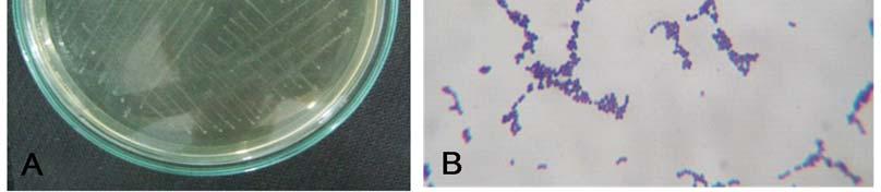 Kết quả kiểm tra một số chỉ tiêu hình thái, vi khuẩn tạo khuẩn lạc tròn nhỏ, màu trắng đục, nhỏ li ti.