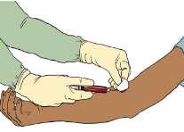 patient NOT to bend the arm Step 3m: Remove blood collector tube from holder and put in