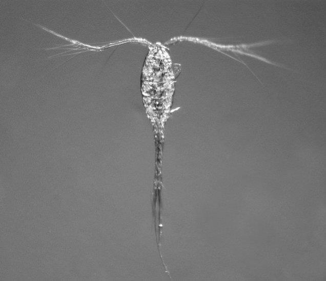 Sakupljeni zooplankton sadrži najviše vrsta koje pripadaju veslonošcima (Copepoda) i vodenbuhama (Cladocera). U uzorcima prebrojite broj pojedine vrste raka.