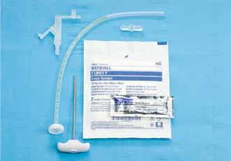 non-balloon replacement PEG A replacement tube designed like an initial placement feeding tube to better withstand the acidic conditions of the gastric cavity.