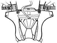 Place the folded canopy in the deployment bag and pull all of the bridle cord out through the grommet in the top of the bag. (Fig.8) Fig.