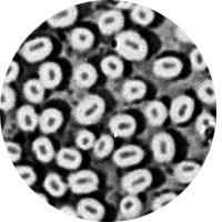 Kapsula (slika 3) je guste konzistencije i ne može se lako odstraniti sa ćelije. Prema debljini, razlikuju se mikrokapsula (debljine do 0,2 μm) i makrokapsula (debljine iznad 0,2 μm).
