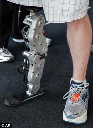 pogonske jedinice koja po svojoj težini i gabaritima ne bi narušavala osjećaj udobnosti korisnika proteze.