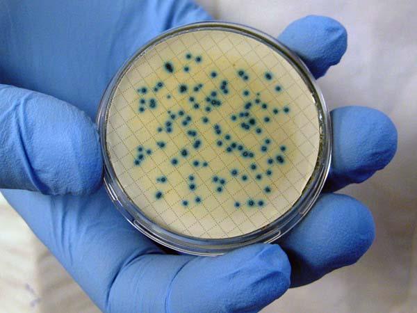 Bacterial Groups Enterococci: Two species (EPA) Can