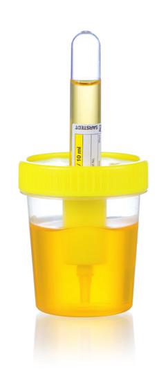 Transportation, storage, and subsequent laboratory testing can all take place using the V-Monovette Urine.