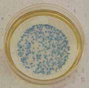 orms are a broad group of organisms that include fecal coliform bacteria as well as E. coli. The enterococci group has been determined to be a good indicator of water-contact associated gastroenteritis.