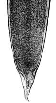 Philometra ovata (posterior part)