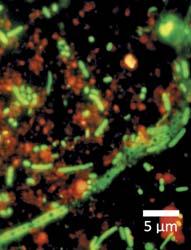 KOT PRVOBITNI SESTAVNI DEL PODZEMNEGA SISTEMA IZVIRA KRAJCARCE (TRIGLAVSKI NARODNI PARK) Zgoraj: Mikrobne celice (zeleno), obarvane z akridinoranžem. Anorganski delci so obarvani oranžno.