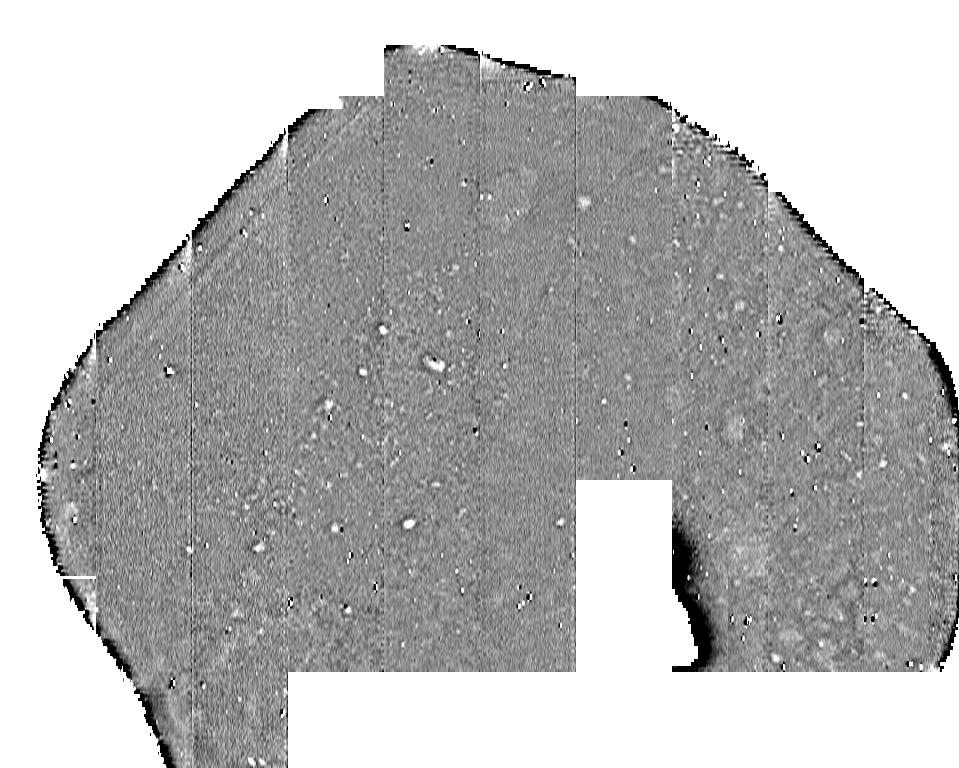 THE WESSEX HILLFORTS PROJECT Fig 2.31 Greyscale plot of the magnetometer data from Woolbury in relation to the plan of the partially removed hillfort earthworks.