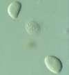 - klijanjem teleutospore na svakoj stanici nastaje 4-staničan bazid s bazidiosporama Stadiji razvoja hrđa 1. 0 stadij - stadij SPERMAGONIJA (spermacijske spore - n) 2.