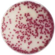 ß-galactosidase, producing a red color. EXAMPLES OF WHAT PLATES CAN LOOK LIKE 1 No Growth = 0 Plate remains white to off white color.