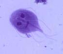 Waterborne Pathogens Giardia A microscopic protozoan parasite that lives in the intestine of people and animals.