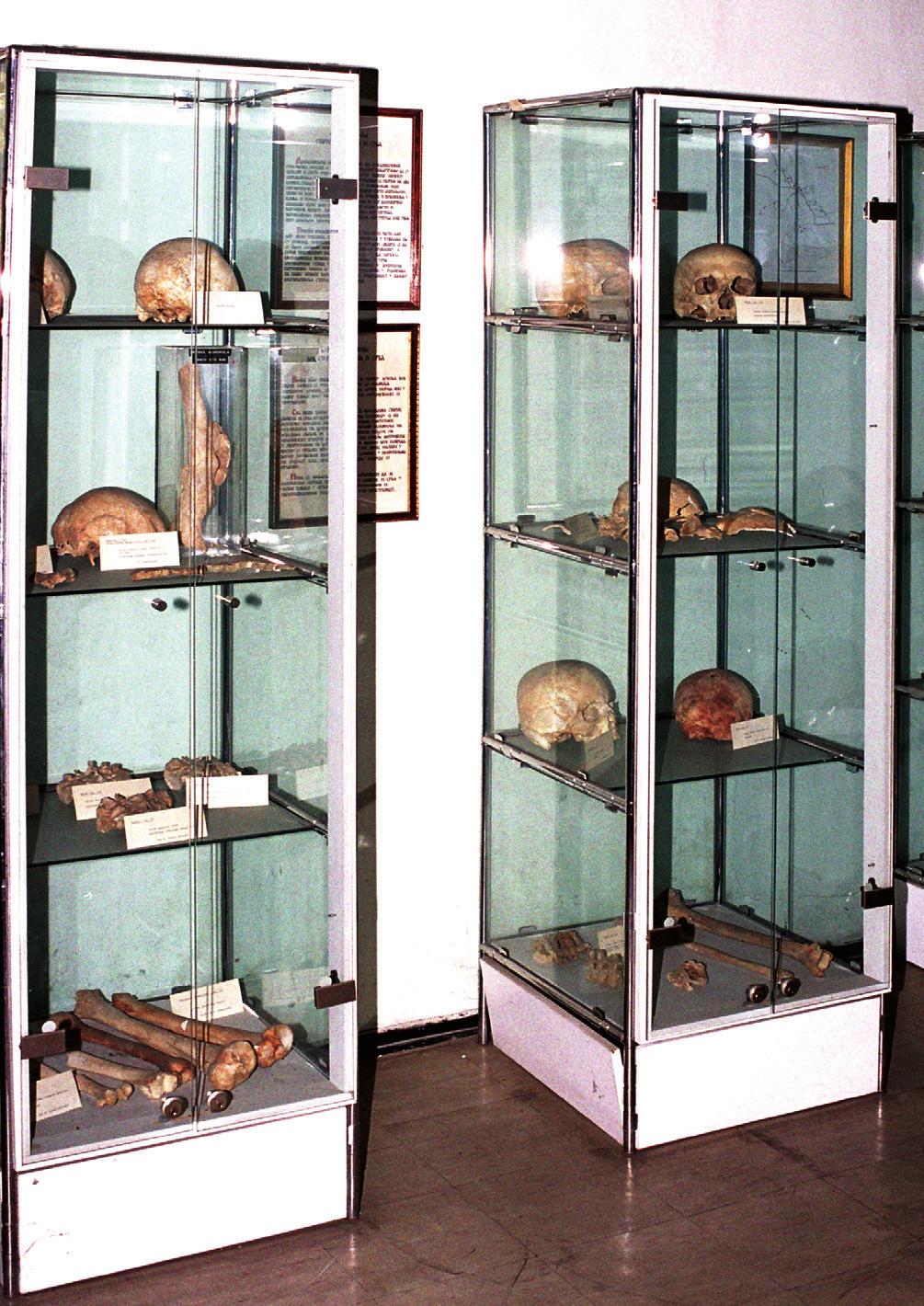 Figure 4 Exhibits of the human pathology collection Slika 4. Dio antropopatološke zbirke There are also a library and an archive.