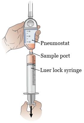 Clean the sample port with the alcohol swab for 15 seconds. Throw the alcohol swab away. 4. Pick up the luer lock syringe. Make sure the plunger is pushed all the way down.