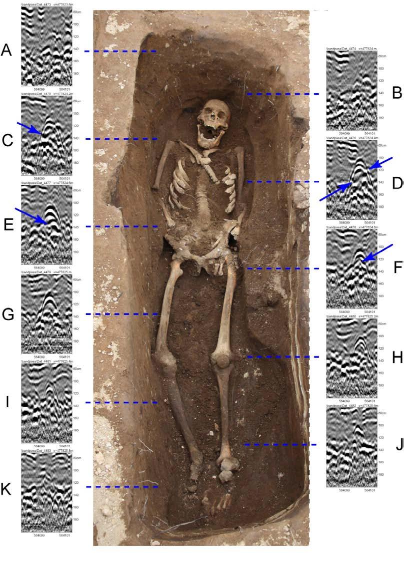 Skeletal Remains from Stóra-Seyla Radar profiles showing relatively wide hyperbolas associated with the upper body chest cavity