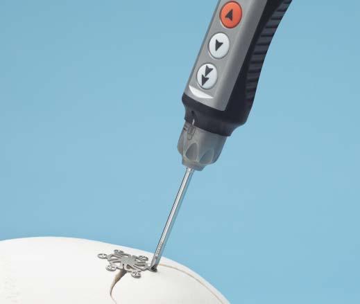 Alignment When placing screws, maintain vertical alignment of the screwdriver and screw to prevent